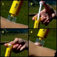 SAWYER EXTRACTOR® PUMP KIT - 4 darabos harapás elleni készlet B6B - KNIFESTOCK